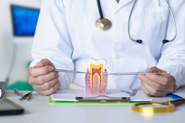 Best Knocked-Out Tooth (Avulsed Tooth) Treatment in Germantown, TN